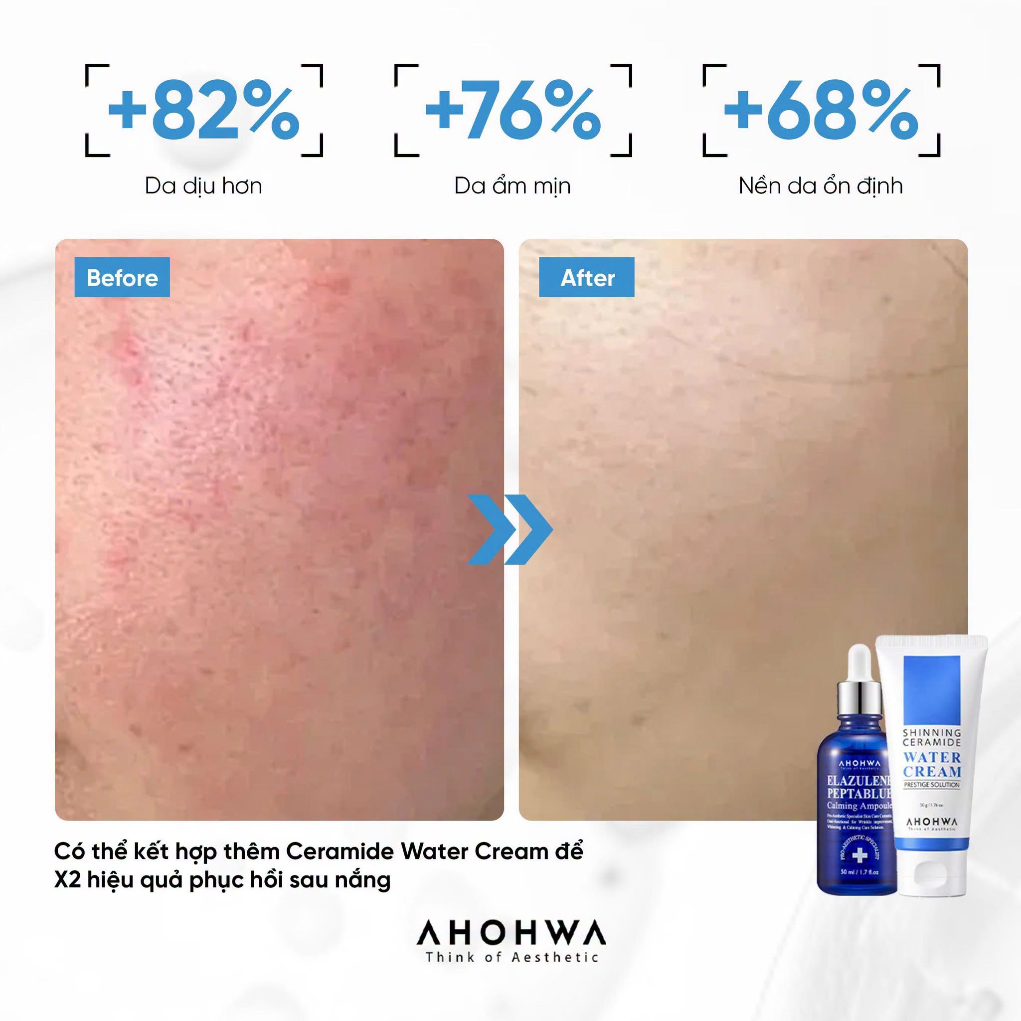 Tinh chất phục hồi trẻ hóa tế bào sinh học Ahohwa Elazulene Peptablue Calming Ampoule