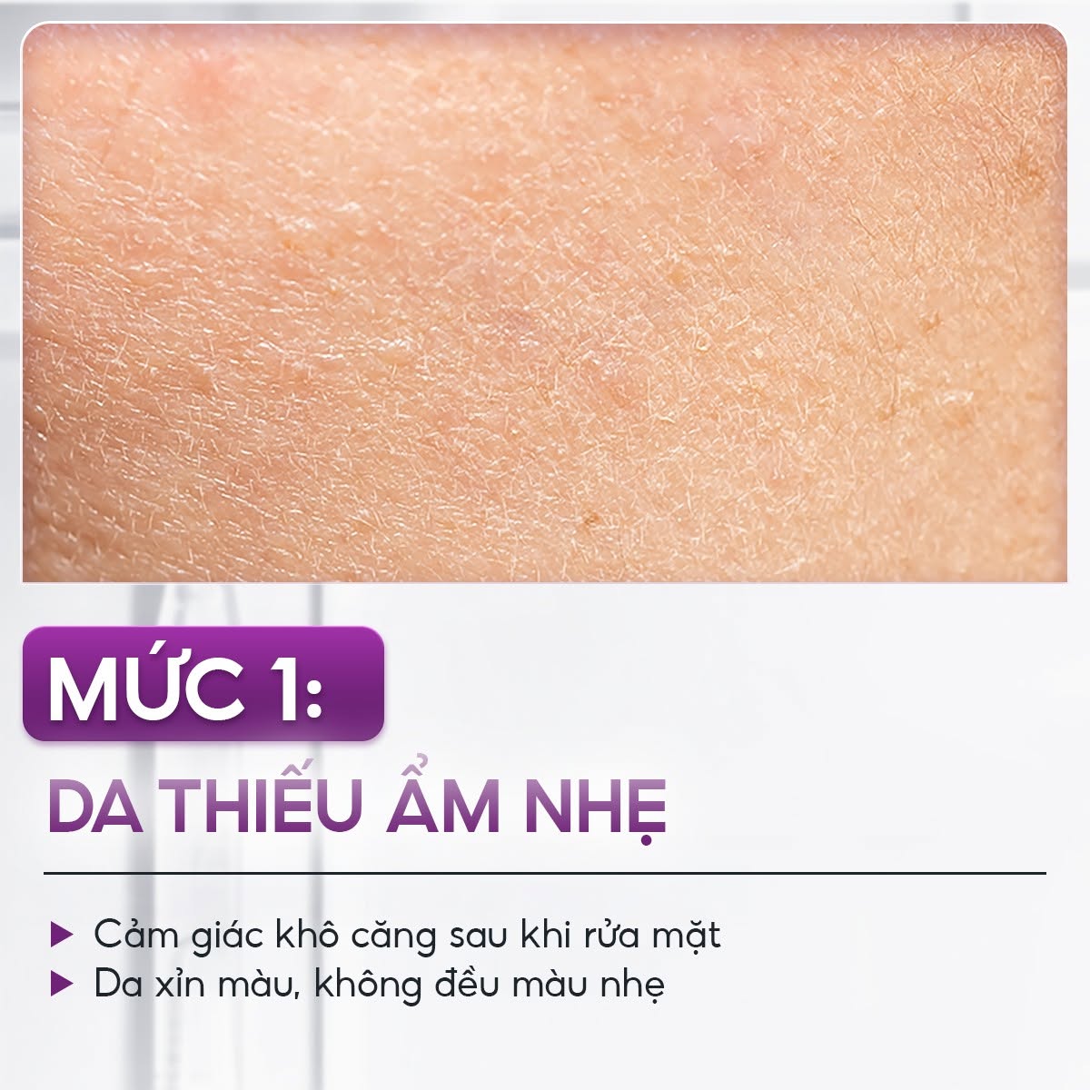 Tinh chất vial giữ ẩm làm mờ nếp nhăn ngăn ngừa sẹo SkinClinic Hyaluronic Acid 3,5%