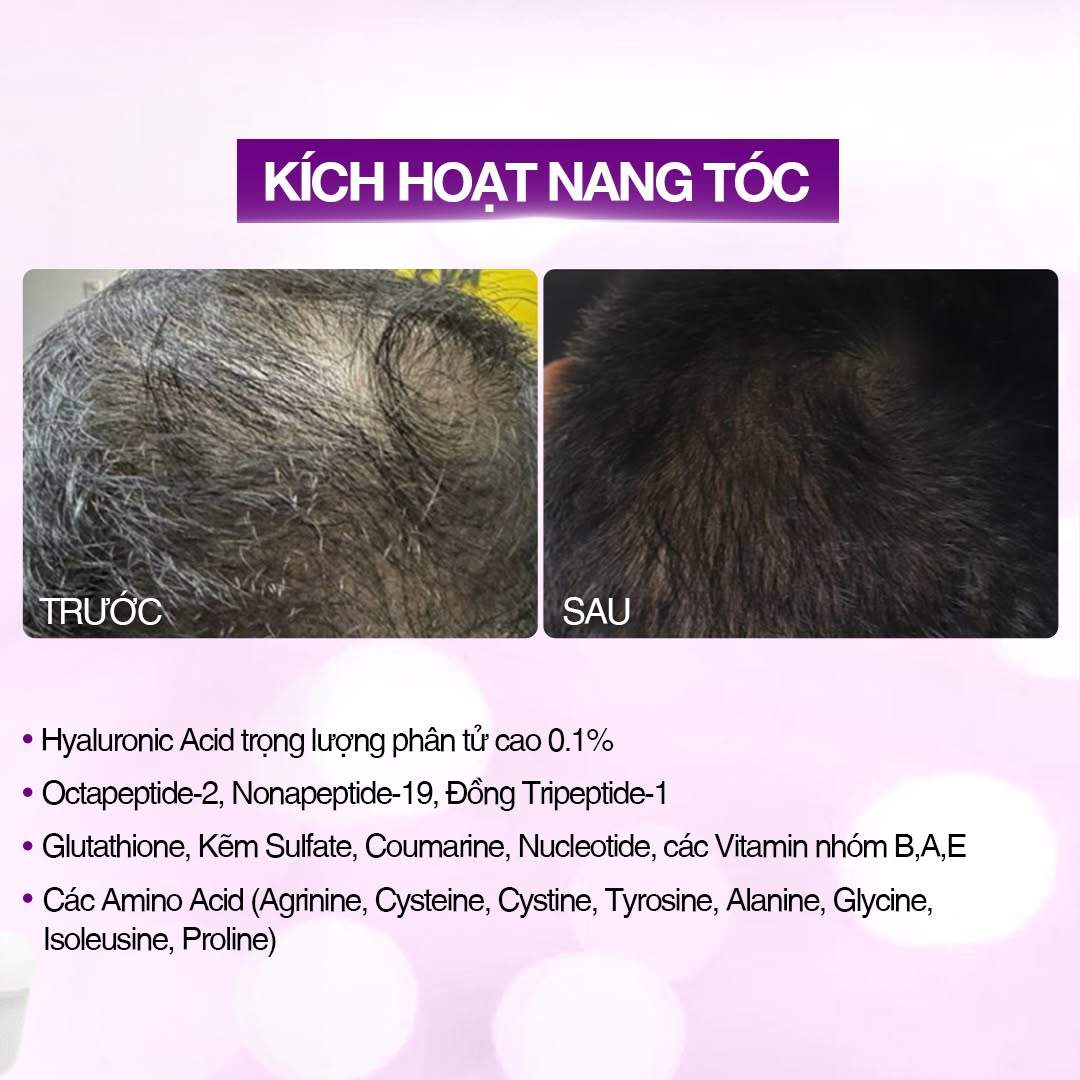 Tinh chất vial kích thích mọc tóc cải thiện rụng tóc SkinClinic Hair Peptide