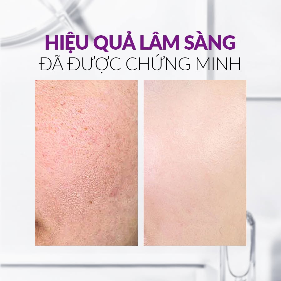 Tinh chất vial sáng da mờ thâm nám tàn nhang chống lão hóa SkinClinic Melanyc Peptide