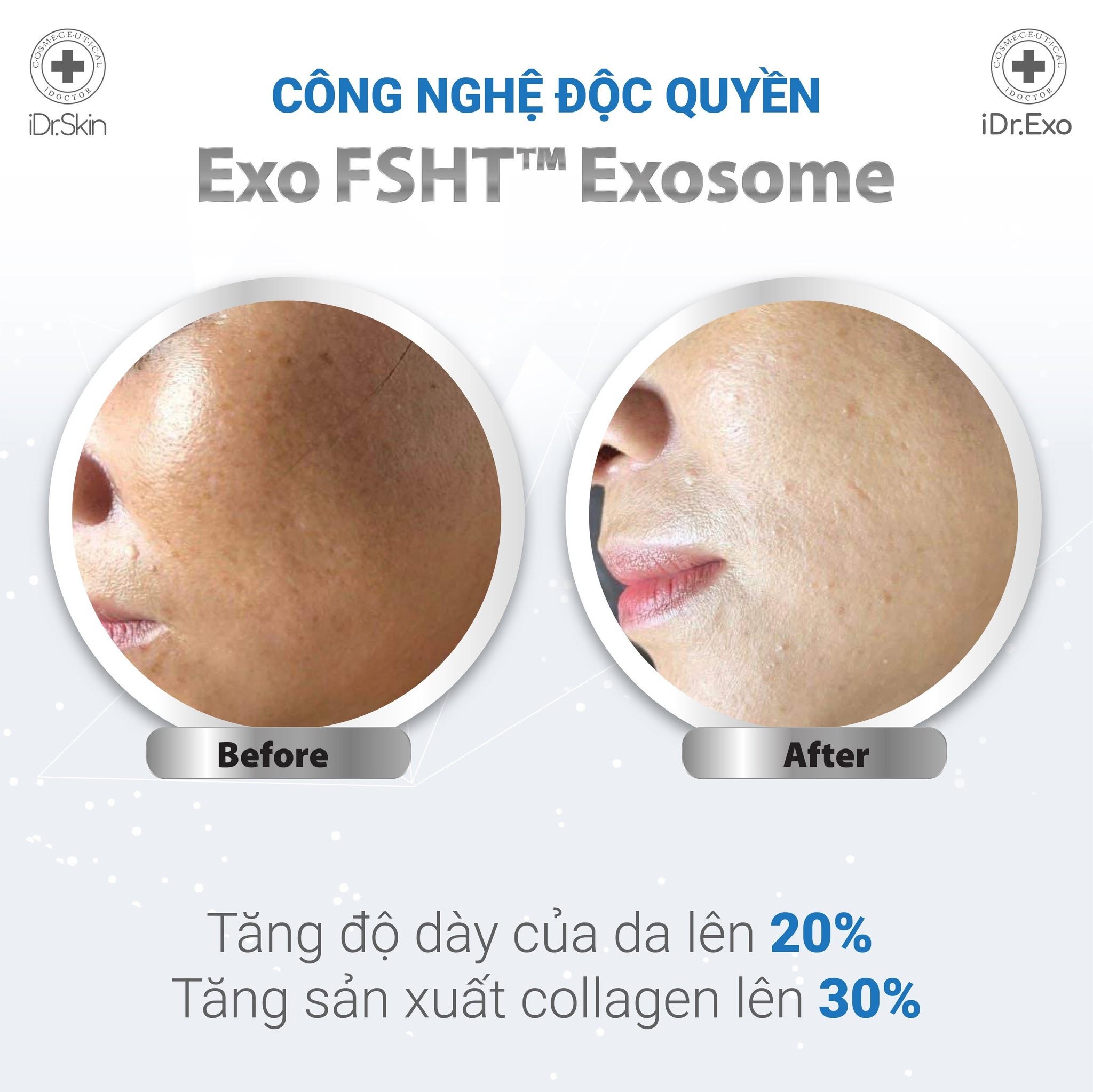 Bộ đôi chuẩn hoá làn da trắng sáng iDr.Skin iDr.Exo BMW 2.jpg