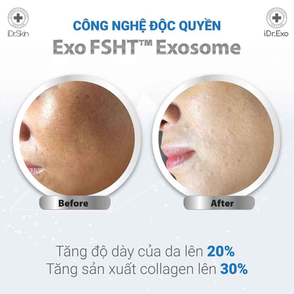 Bộ đôi chuẩn hoá làn da trắng sáng iDr.Skin iDr.Exo BMW (3).jpg