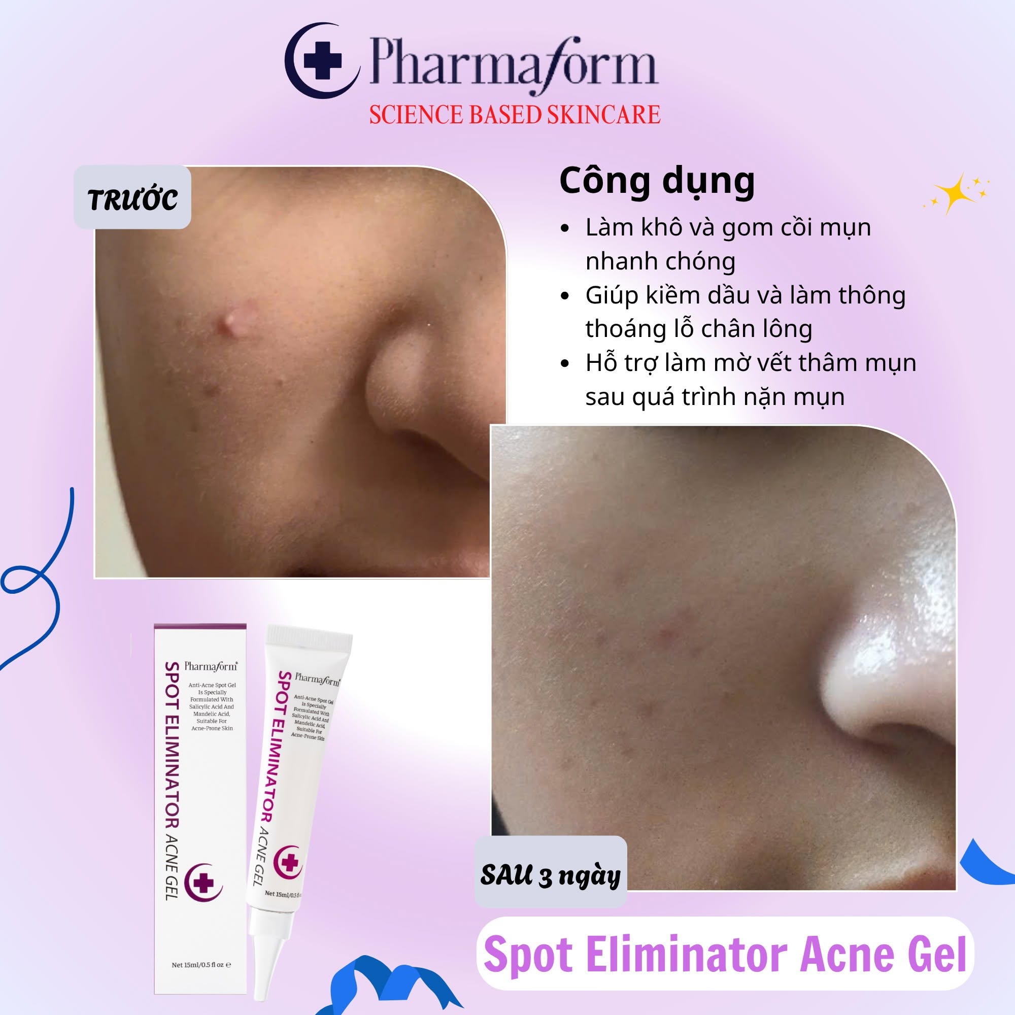 Gel Giảm Mụn, Giảm Dầu Thừa Pharmaform Spot Eliminator Acne Gel 15ml.jpg