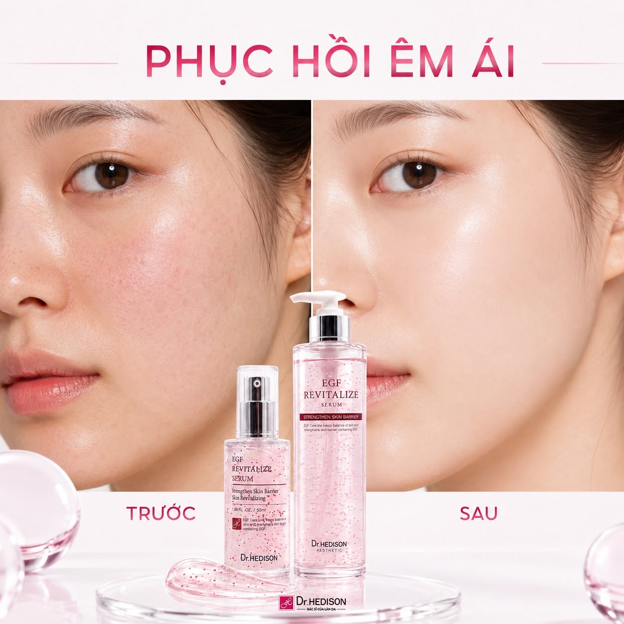 Huyết thanh phục hồi và dưỡng ẩm da Dr.HEDISON EGF Revitalize Serum.jpg
