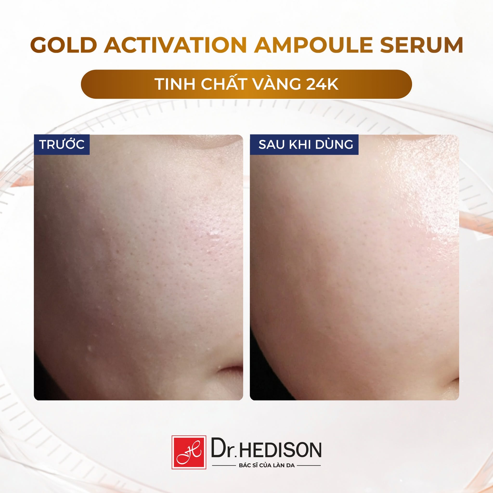 Huyết thanh vàng 24K dưỡng sáng và chăm sóc da lão hóa Dr.HEDISON Gold Activation Ampoule Serum 1.jpg