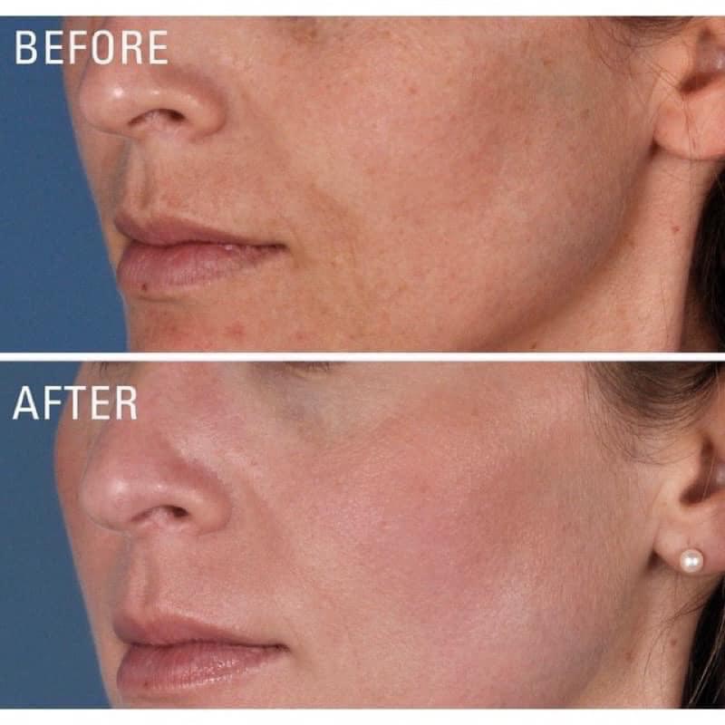 Kem-dac-tri-nam-duong-trang-da-Zo-Skin-Health-Pigment-Control-Blending-Creme-2-80ml_Kem đặc trị nám dưỡng trắng da Zo Skin Health Pigment Control + Blending Crème 2% - 80ml.jpg