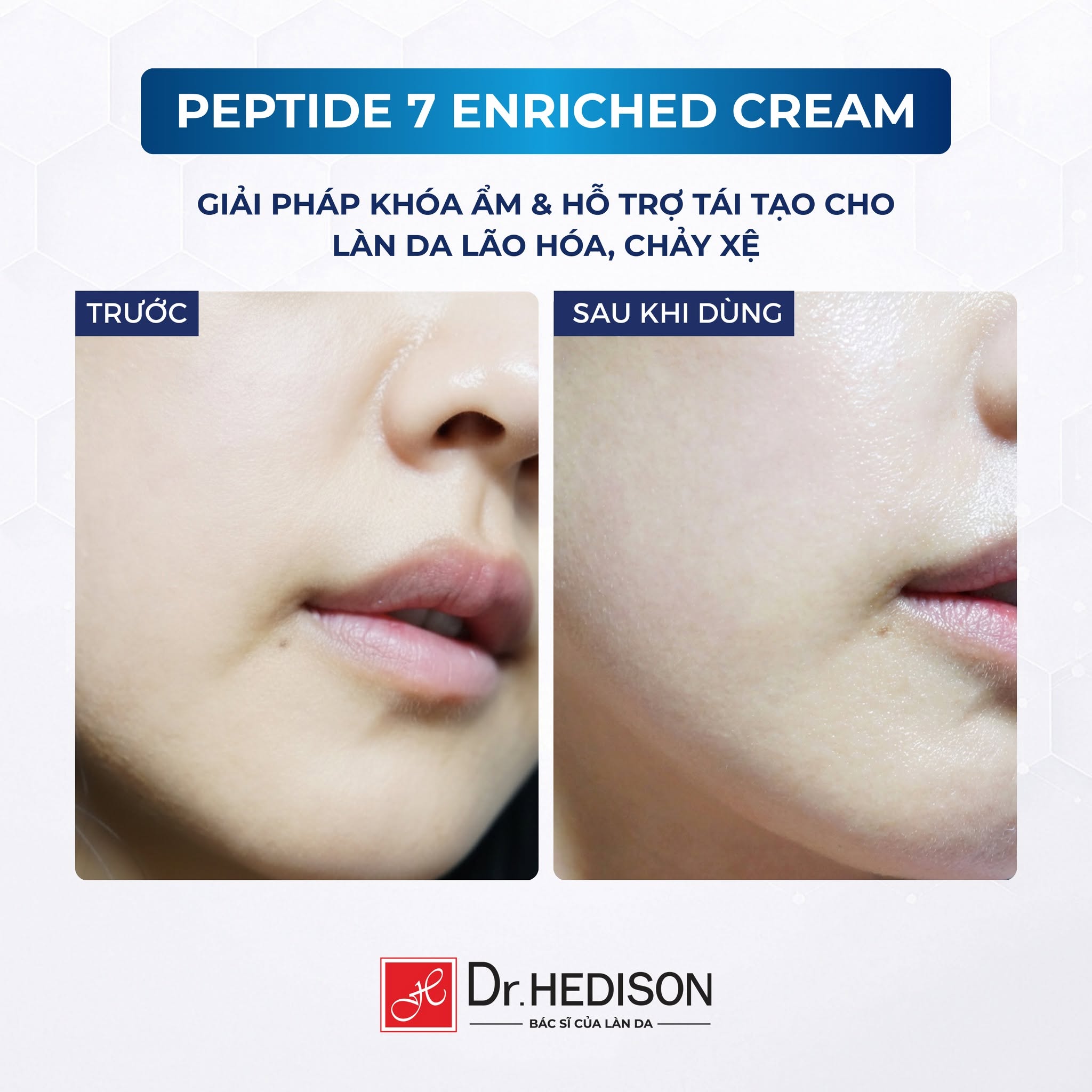 Kem dưỡng giảm nếp nhăn, chăm sóc da lão hóa Dr.HEDISON Peptide 7 Enriched Cream 3.jpg