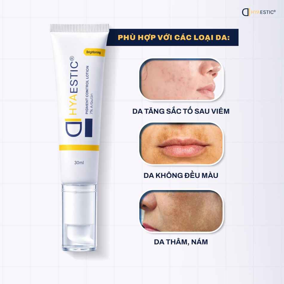 Kem dưỡng hỗ trợ sáng da, giảm nám Hyaestic Pigment Control Lotion 7% Arbutin (4).jpg
