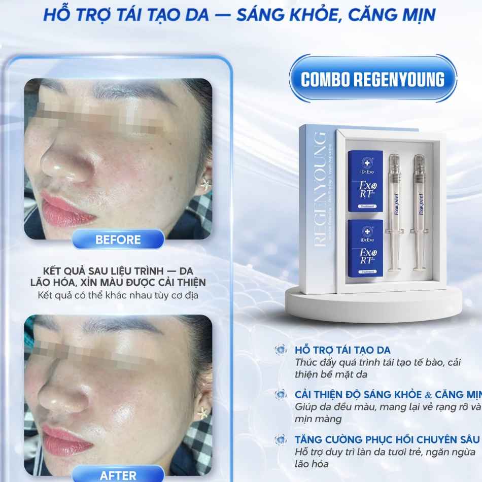 Peel da tái cấu trúc nền da khoẻ mạnh iDr.Skin iDr.Exo Peel.jpg