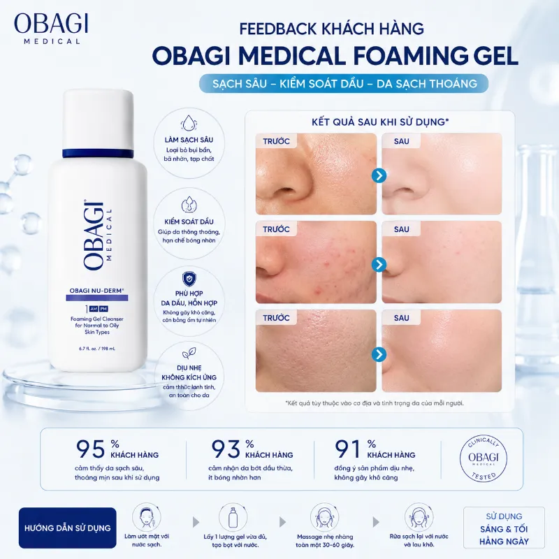 Sữa Rửa Mặt Tạo Bọt Cho Da Thường Đến Da Dầu Obagi Nu-Derm Foaming Gel 200ml 11.webp