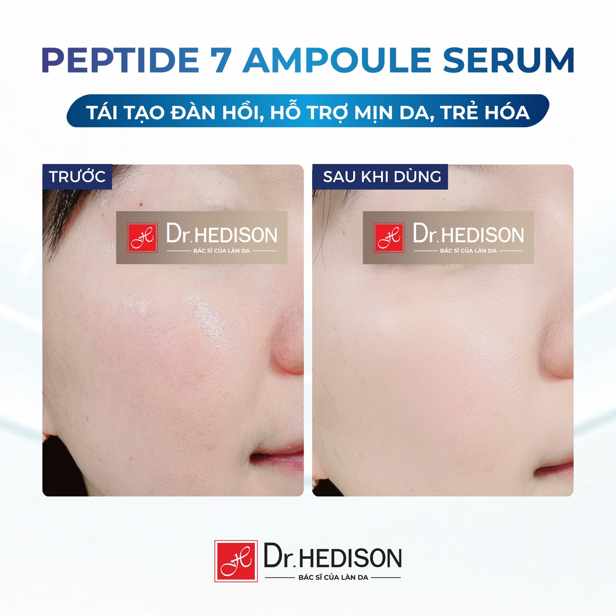 Tinh chất giảm nếp nhăn, tăng đàn hồi cho da lão hóa Dr.HEDISON Peptide 7 Ampoule Serum.jpg