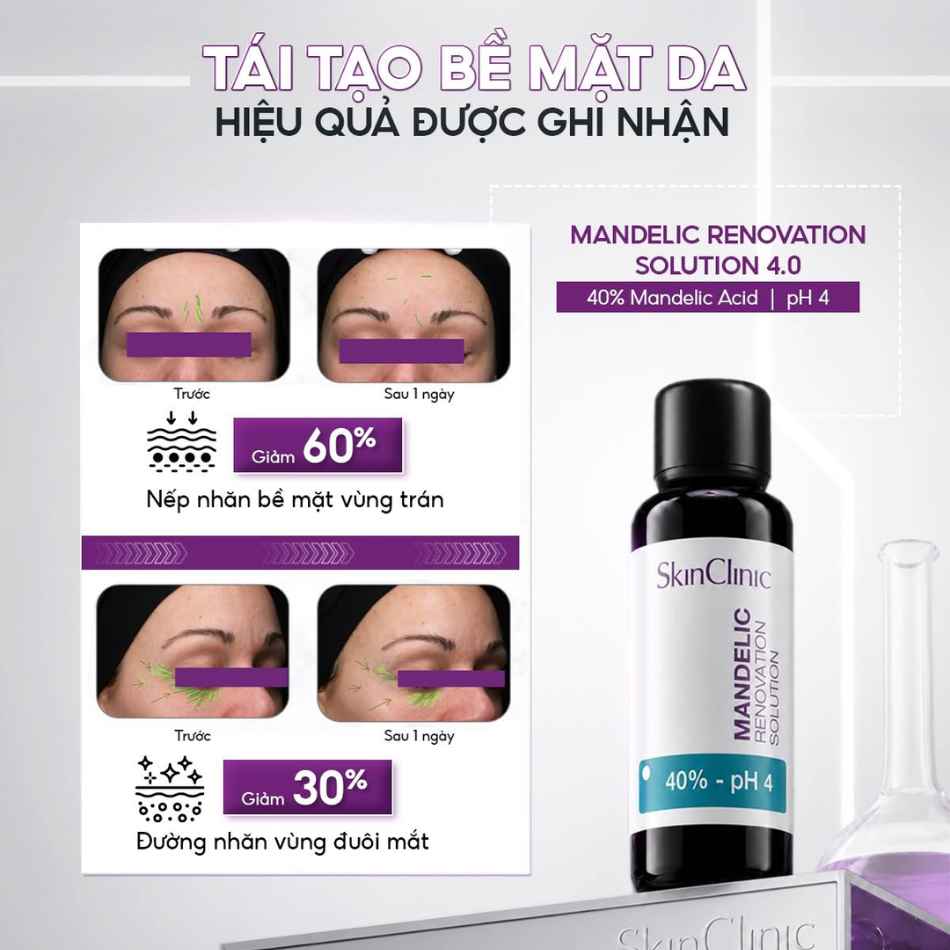Tinh chất peel không bong giảm tiết bã nhờn mụn trứng cá SkinClinic Mandelic Renovation Solution.jpg
