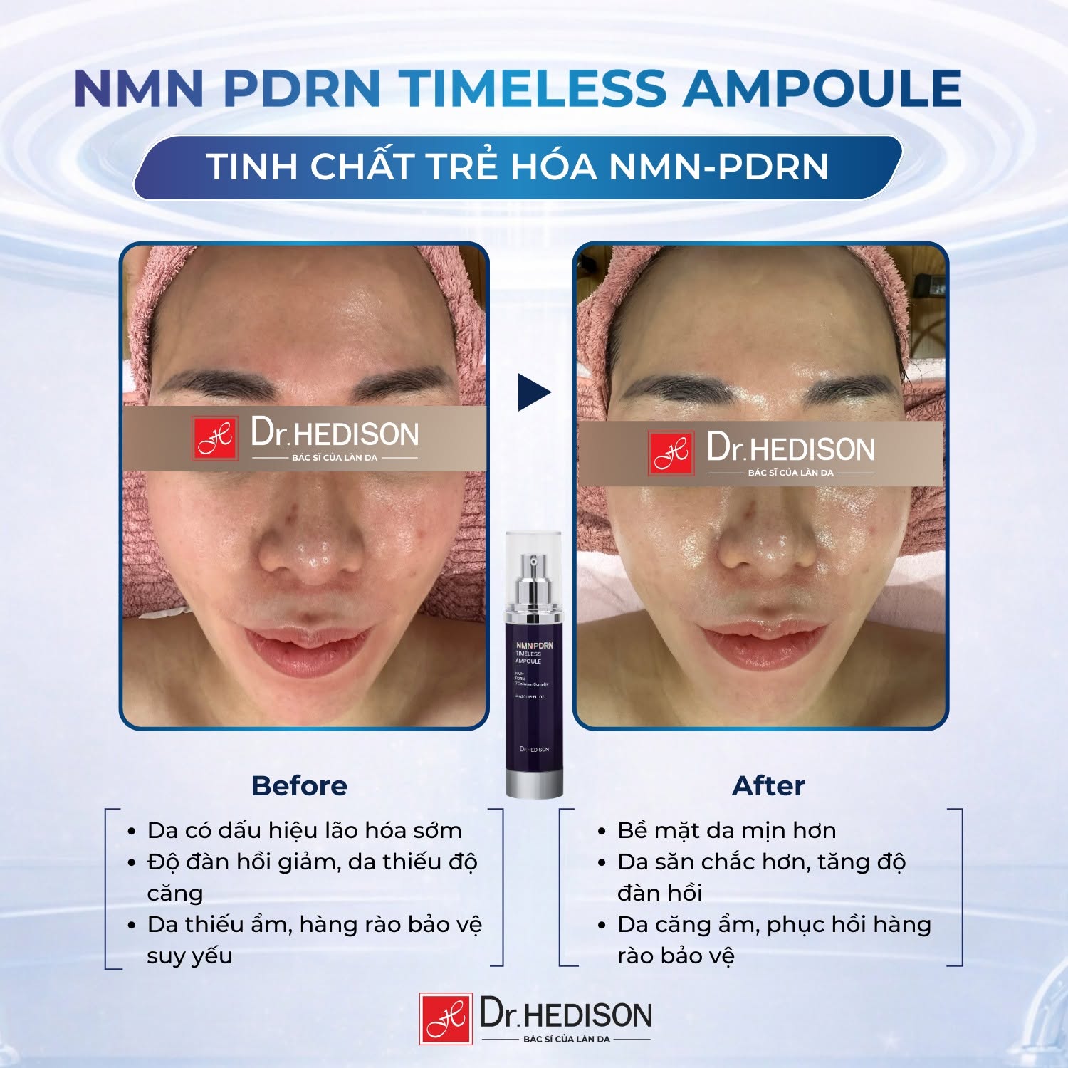 Tinh chất trẻ hóa Dr.HEDISON NMN PDRN Timeless Ampoule 3.jpg