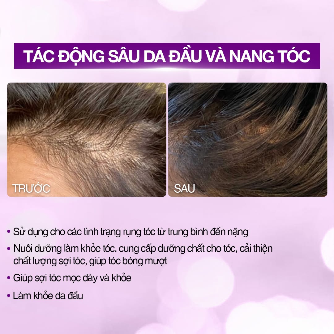 Tinh chất vial kích thích mọc tóc cải thiện rụng tóc SkinClinic Hair Peptide.jpg