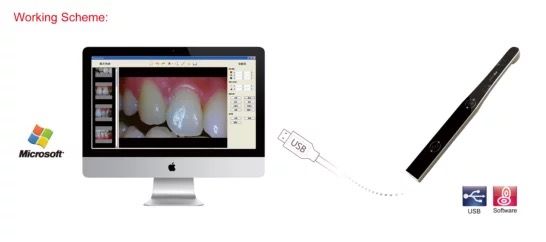 Camera nội soi không dây Apple Dental