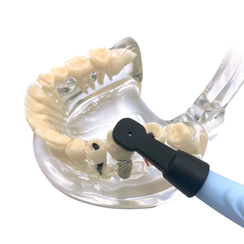 Định Vị Implant!