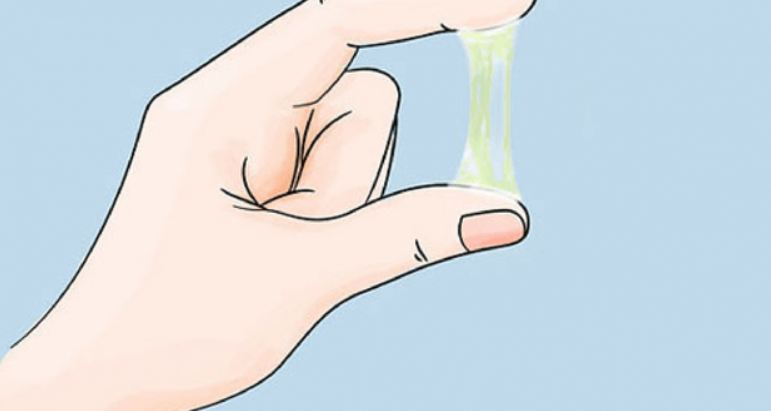 Cảnh báo khí hư có sắc vàng sau khi ân ái
