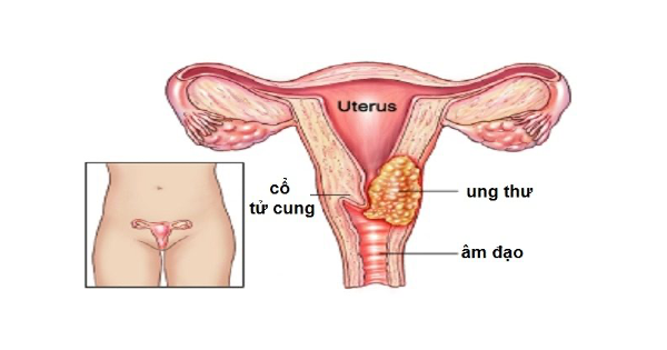 cau-be-co-the-vao-sau-bao-nhieu-3.png