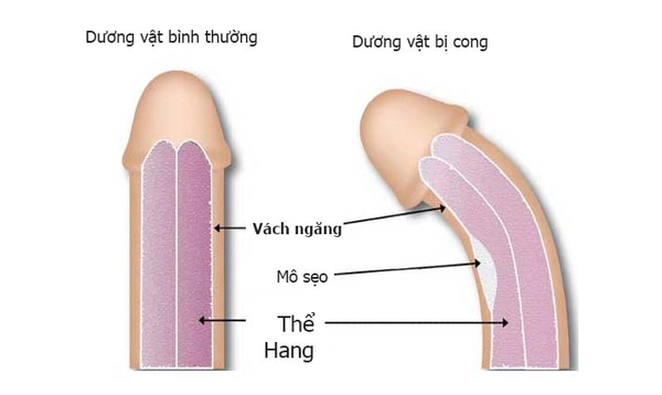 duong-vat-cong-hay-thang-tot-hon-2.png