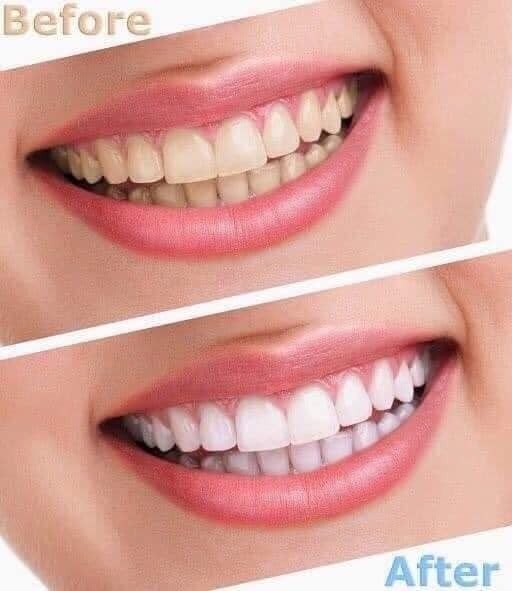 KEM ĐÁNH RĂNG TRẮNG RĂNG 3 TÁC ĐỘNG CREST 3D WHITE ULTRA TEETH WHITENING TOOTHPASTE, VIVID MINT, HƯƠNG BẠC HÀ THE MÁT (147 *5 TUÝP)