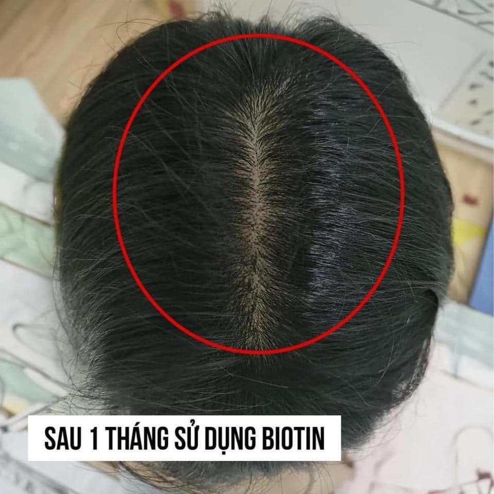 VIÊN UỐNG HỖ TRỢ MỌC TÓC VÀ CHỐNG RỤNG TÓC NATROL BIOTIN BEAUTY 10,000MCG 100 VIÊN - MẪU MỚI