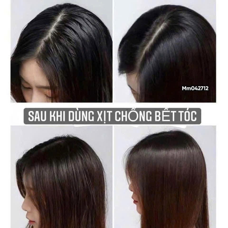 COMBO 2 DẦU GỘI ĐẦU KHÔ CHAI XANH