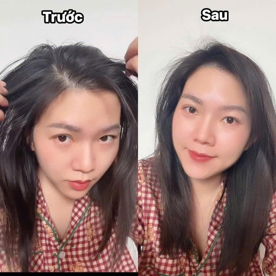 COMBO 2 DẦU GỘI ĐẦU KHÔ CHAI XANH