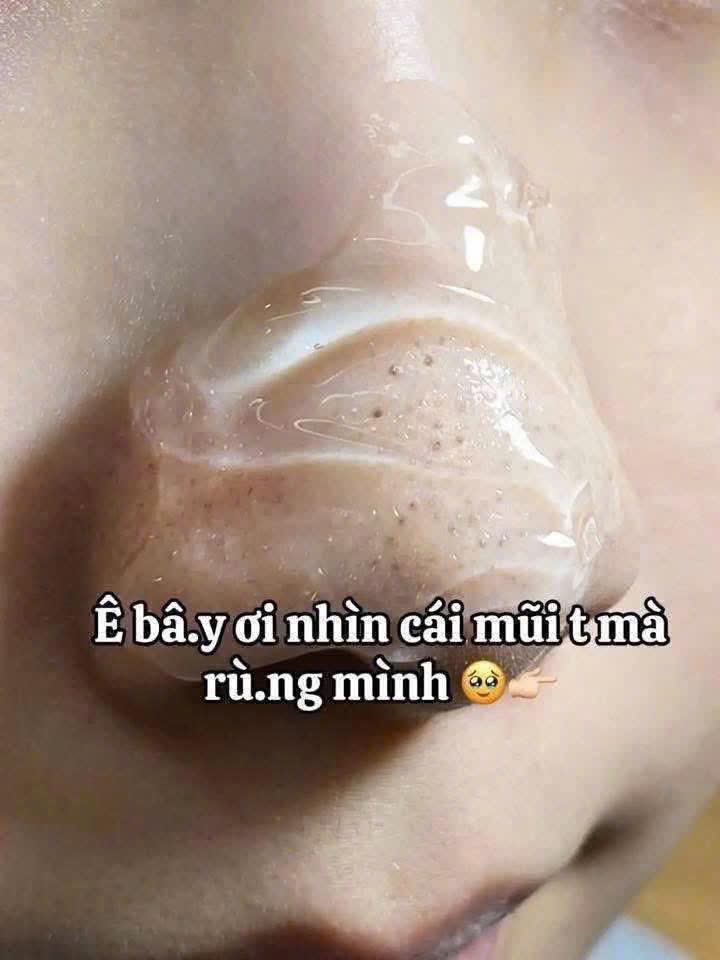 DUNG DỊCH Ủ MỤN ĐẦU ĐEN