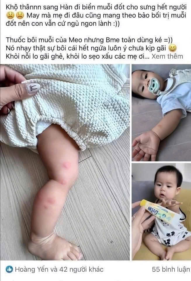 KEM BÔI MUỖI HQ