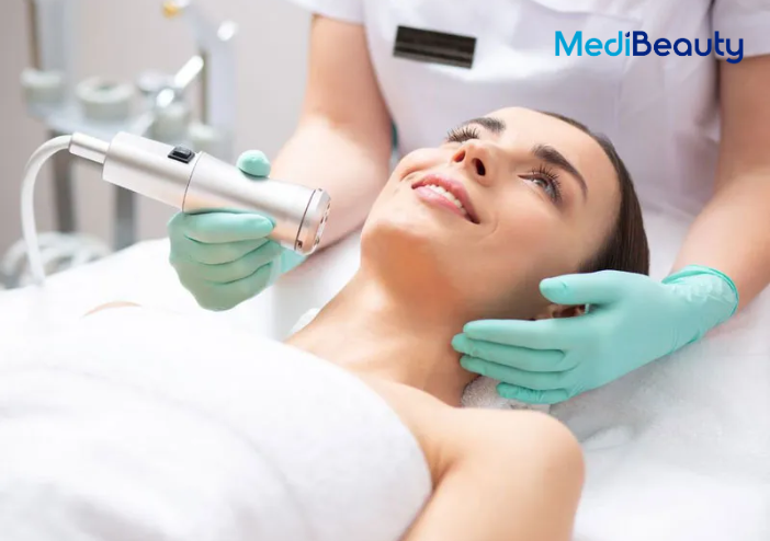 Meso không kim là gì? Vì sao được nhiều người quan tâm?