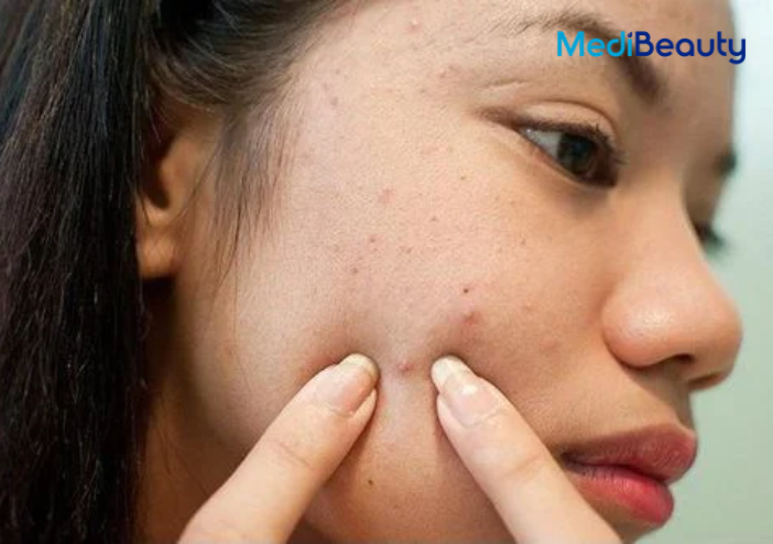 Trước khi xông mặt bằng sả, chanh, gừng, bạn cần biết gì?