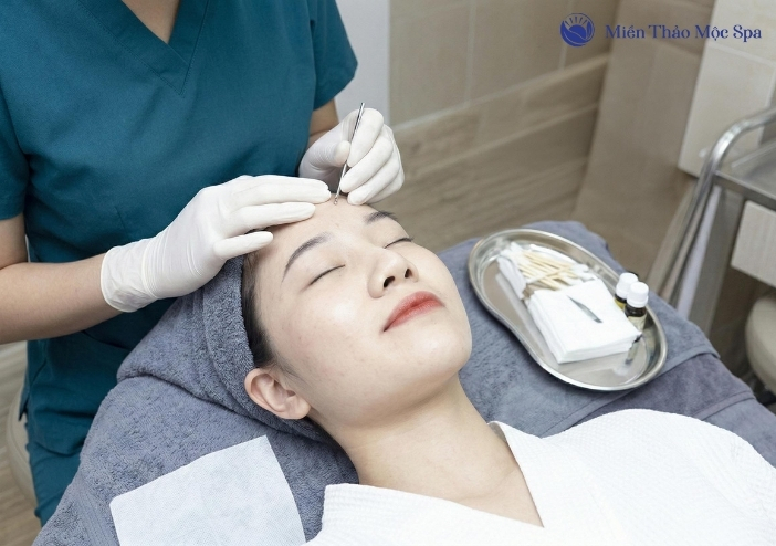 Lieu trinh lay nhan mun chuan Y Khoa tai Mien Thao Moc Spa.jpg