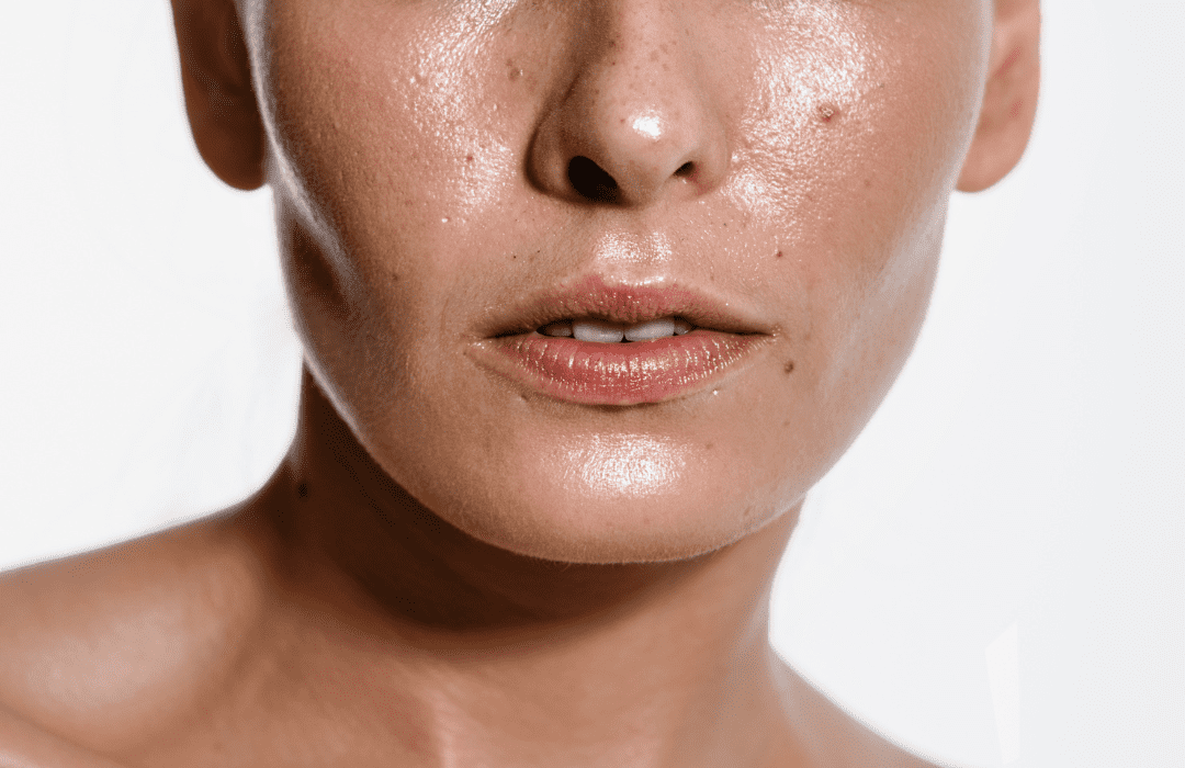 Niacinamide-Bi-quyet-kiem-soat-dau-nhon-hieu-qua-cho-lan-da-bong-dau.png