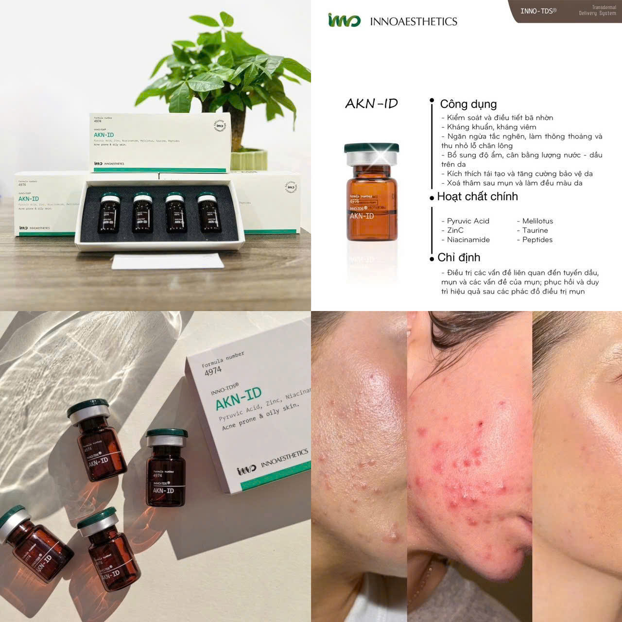 Hoạt chất meso kiềm dầu hiệu quả trị mụn Innoaesthetics AKN-ID (nguyên hộp).webp