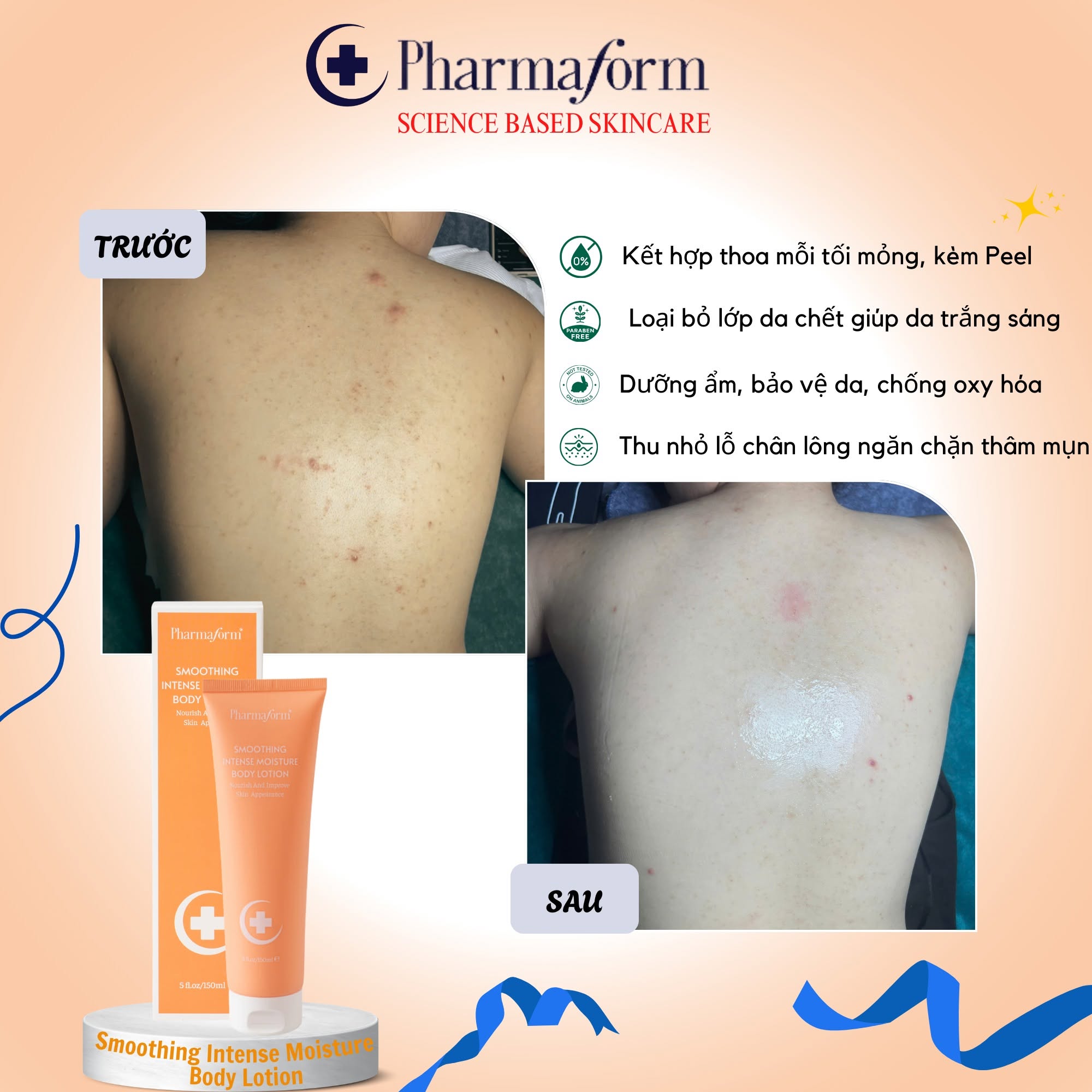 Kem loại bỏ tế bào chết duy trì làn da mềm mại Pharmaform Smoothing Intense Moisture Body Lotion.jpg