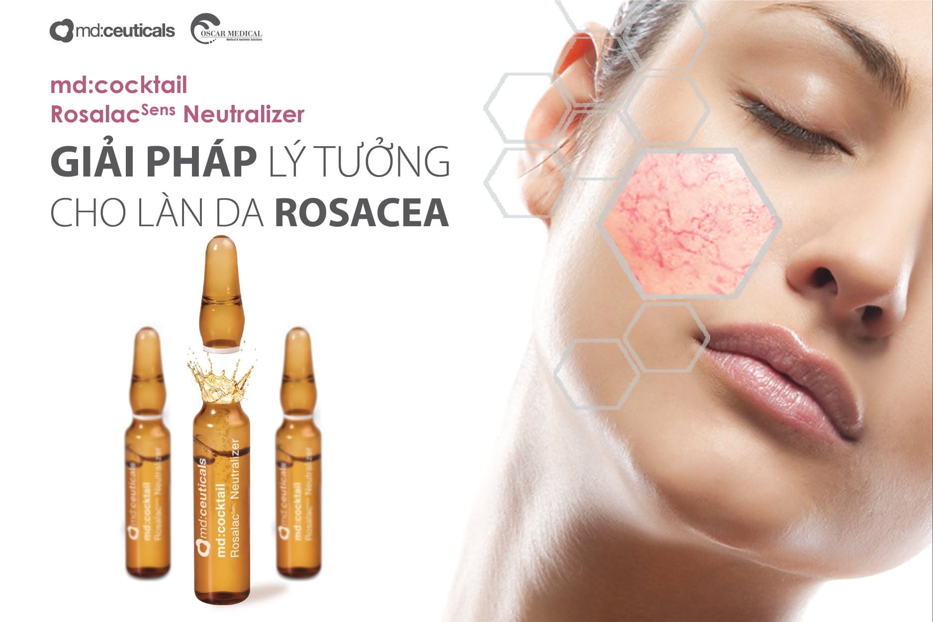 Serum giảm đỏ kháng viêm phục hồi da nhạy cảm, da bị rosacea MdCeuticals MdCoctail Rosalacsens Neutralizer.jpg