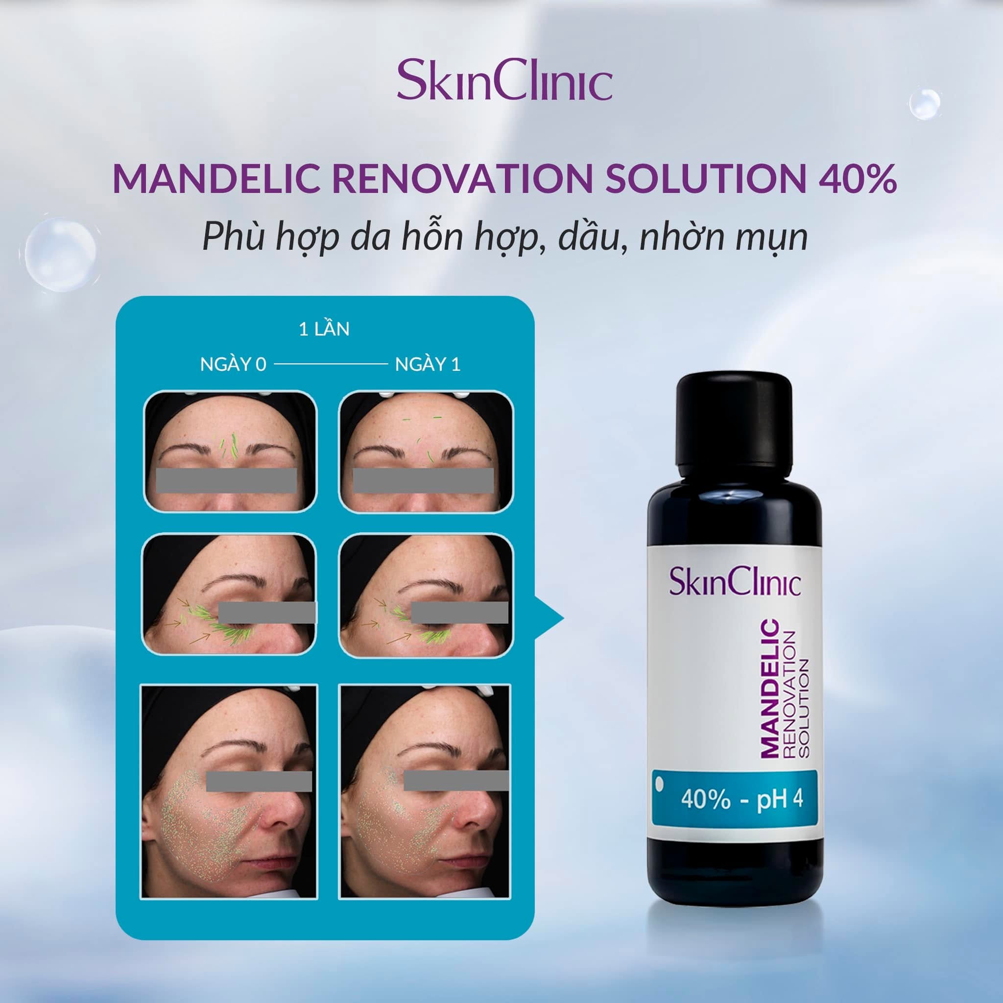 Tinh chất peel không bong giảm tiết bã nhờn mụn trứng cá SkinClinic Mandelic Renovation Solution.jpg