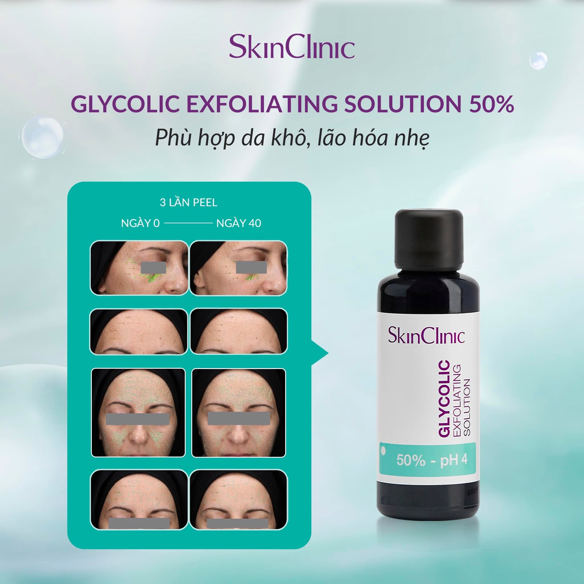 Tinh chất peel không bong làm sạch lỗ chân lông cải thiện kết cấu da SkinClinic Glycolic Exfoliating Solution.jpg