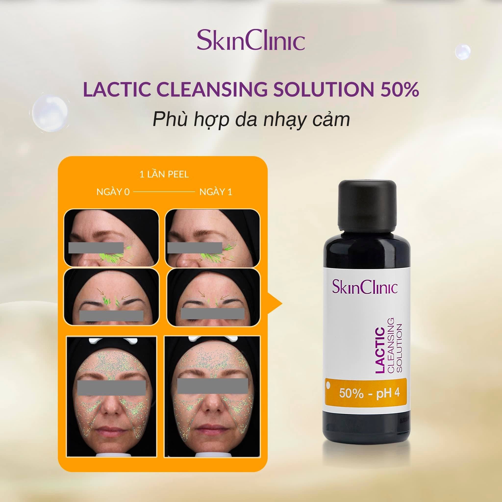 Tinh chất peel không bong làm sạch tế bào chết cải thiện tình trạng đỏ da SkinClinic Lactic Cleansing Solution.jpg