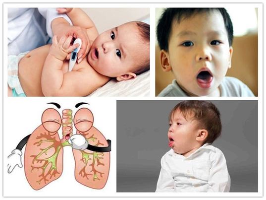 Phân biệt các loại ho ở trẻ nhỏ: Cách nhận biết và xử lý đúng ngay từ đầu