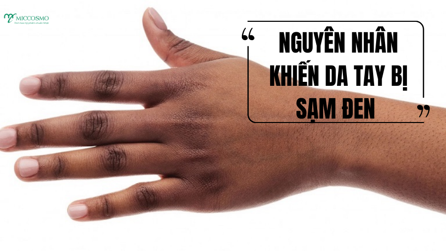 5-nguyen-nhan-khien-tay-bi-sam-den-va-cach-lam-sang-tai-nha-sau-7-ngay_nguyen-nhan-pho-bien-khien-tay-bi-sam-đen.png
