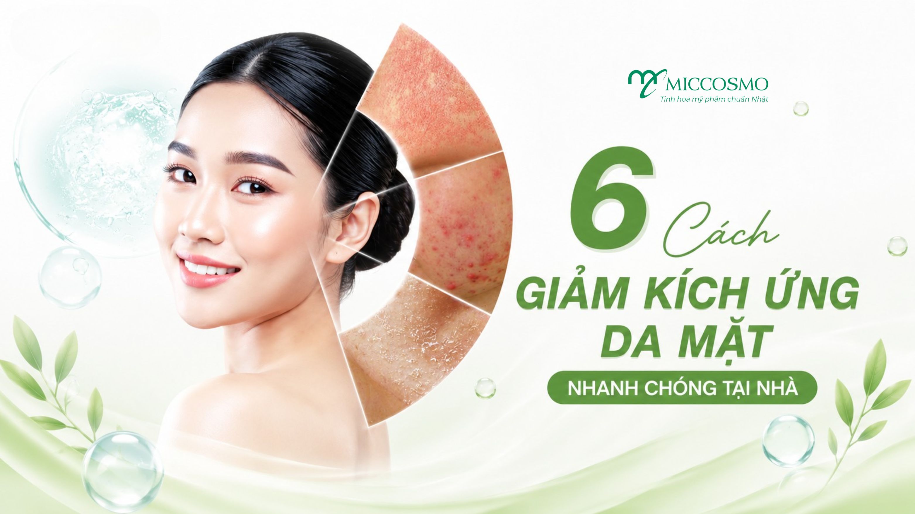 6 Cách Chăm Sóc Giúp Giảm Kích Ứng Da Mặt Nhanh Chóng