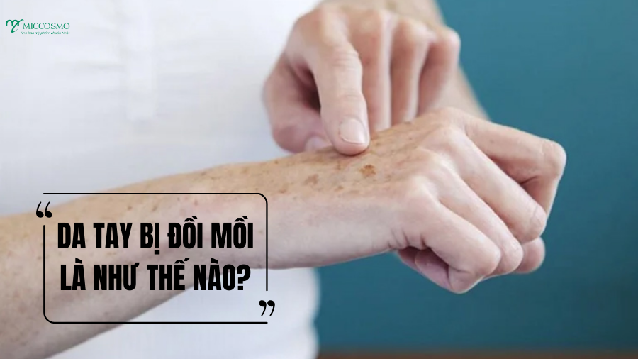 Da-tay-bi-doi-moi-phai-lam-sao-6-cach-cai-thien-hieu-qua-tai-nha.png