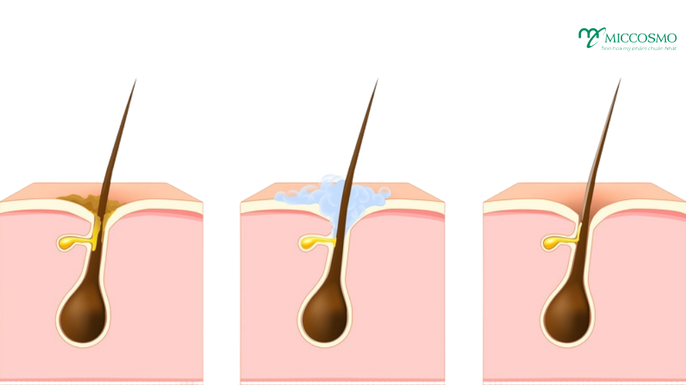 Double-Cleansing-la-gi-3.png