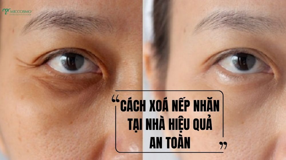 Routine-xoa-nhan-vung-mat-tai-nha-1.jpg
