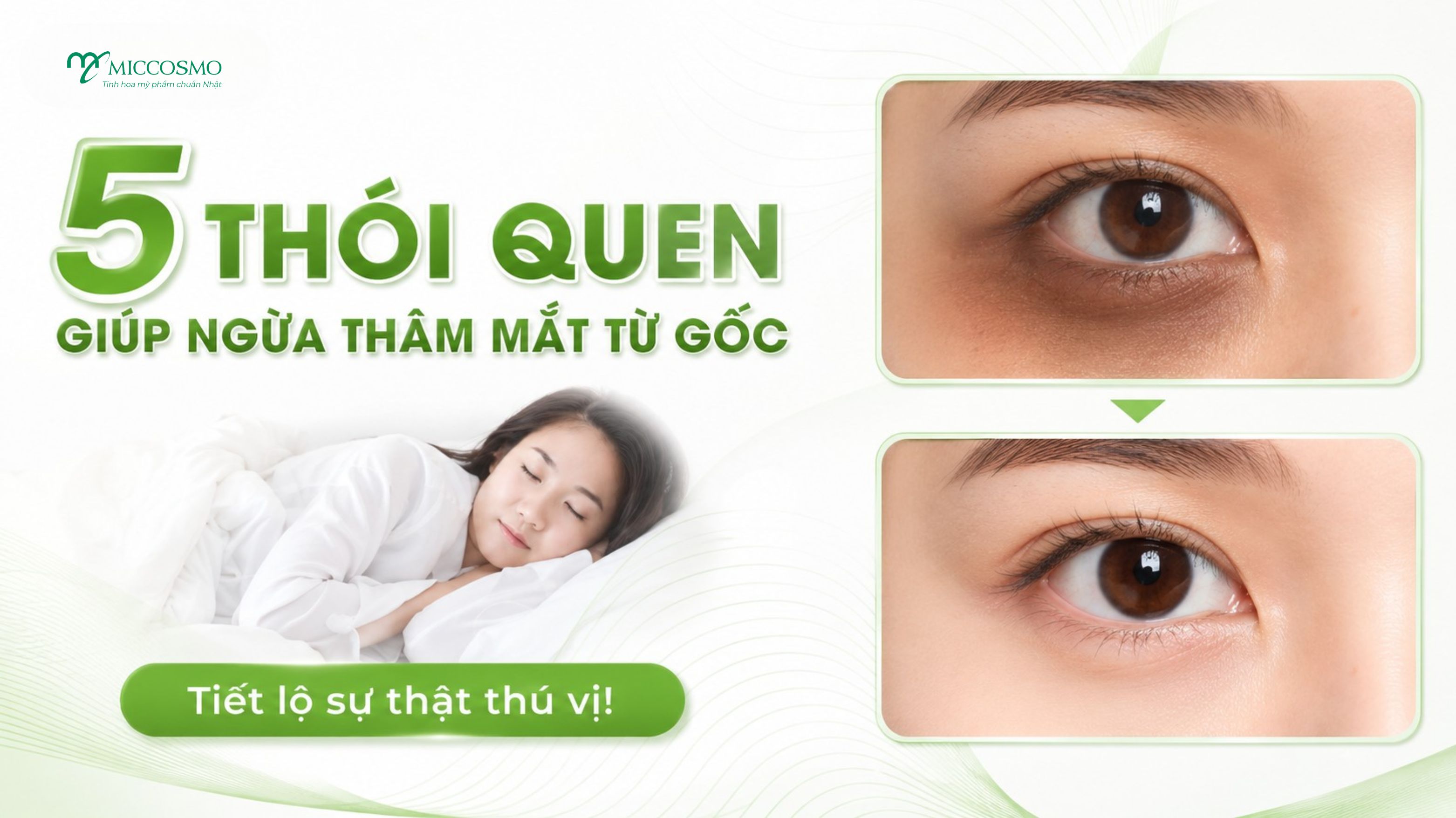 cach-ngua-tham-mat-hieu-qua-tai-nha-2.jpg