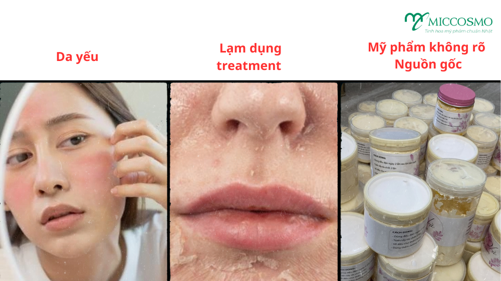di-ung-my-pham-phai-lam-sao-2-1.png