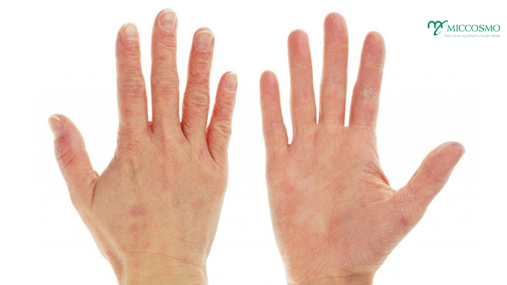 duong-da-tay-bang-vitamin-E1.png