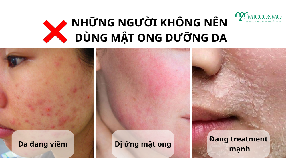 lam-trang-da-bang-mat-ong-12.png