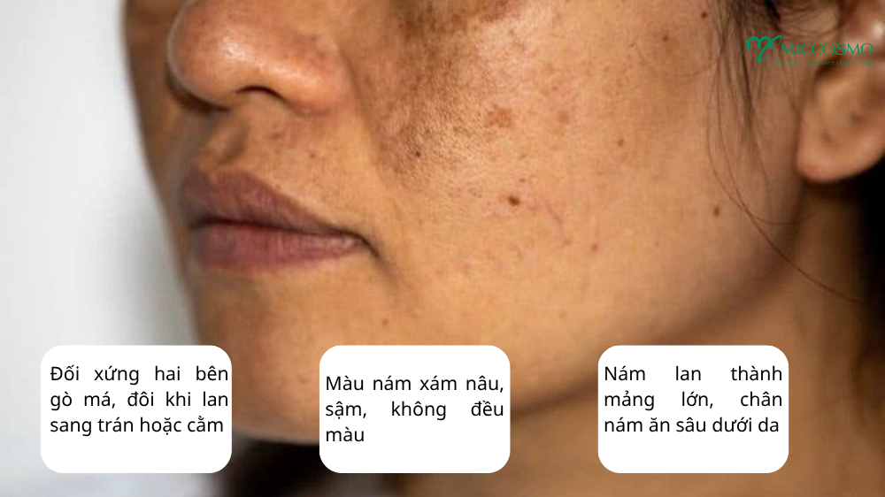nam-da-do-roi-loan-noi-tiet3.png